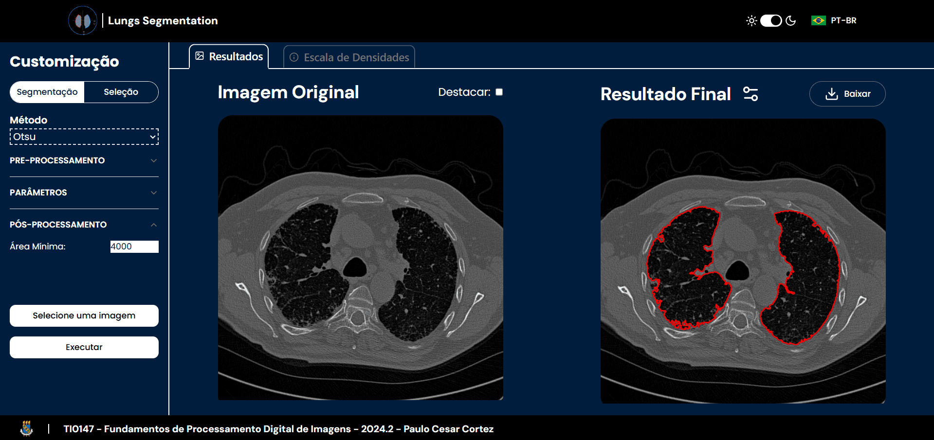Lung Segmentation